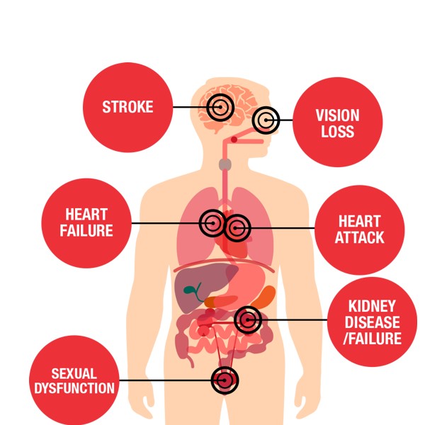 high blood pressure