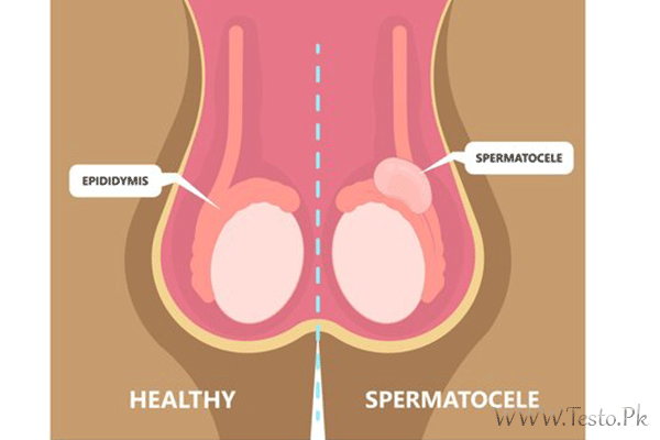 Shrinking Testicles